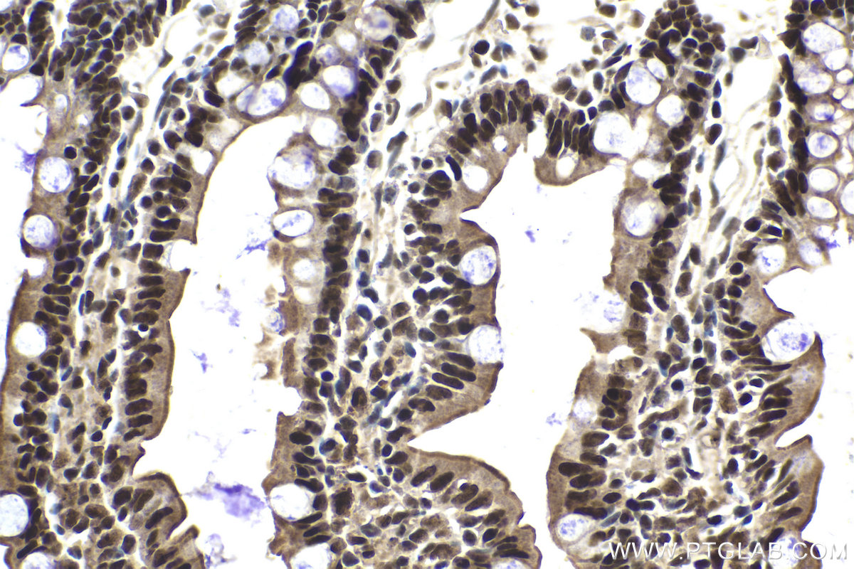 Immunohistochemical analysis of paraffin-embedded rat small intestine tissue slide using KHC2026 (SUPT16H IHC Kit).