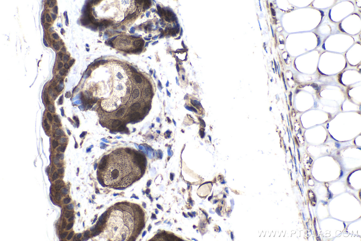 Immunohistochemical analysis of paraffin-embedded mouse skin tissue slide using KHC1939 (TASL/CXorf21 IHC Kit).
