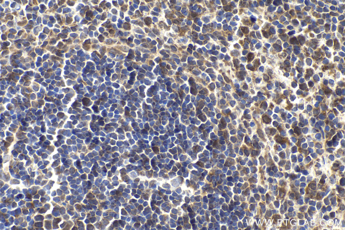 Immunohistochemical analysis of paraffin-embedded mouse spleen tissue slide using KHC1939 (TASL/CXorf21 IHC Kit).