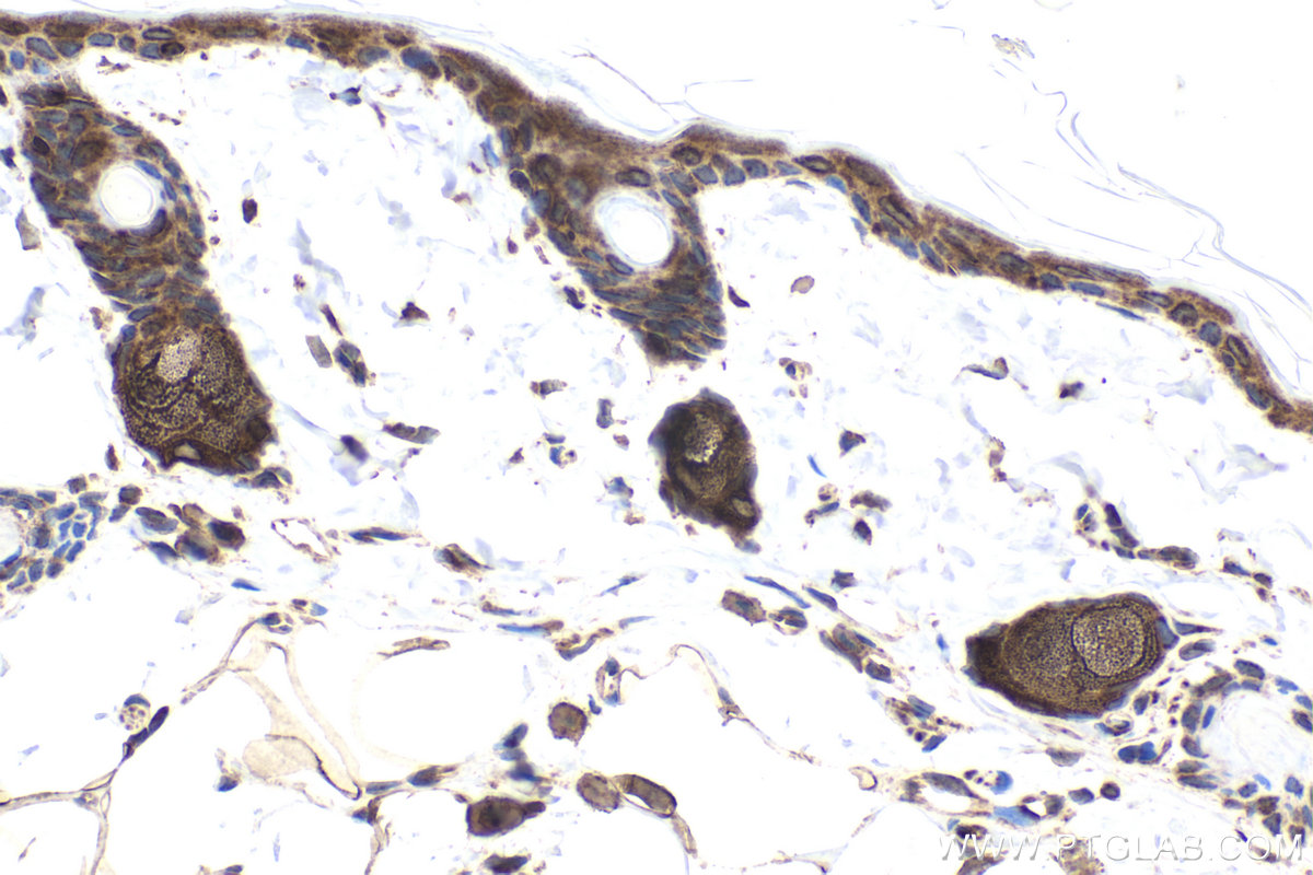 Immunohistochemical analysis of paraffin-embedded rat skin tissue slide using KHC1939 (TASL/CXorf21 IHC Kit).