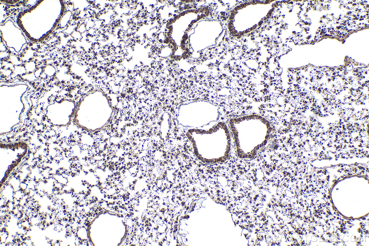 Immunohistochemical analysis of paraffin-embedded mouse lung tissue slide using KHC1936 (TDRD3 IHC Kit).