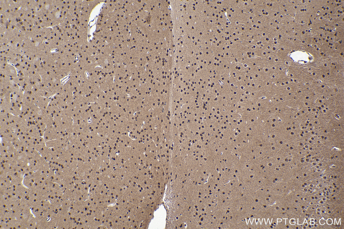 Immunohistochemical analysis of paraffin-embedded mouse brain tissue slide using KHC1971 (TERF2IP IHC Kit).