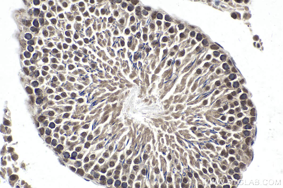 Immunohistochemical analysis of paraffin-embedded rat testis tissue slide using KHC1971 (TERF2IP IHC Kit).