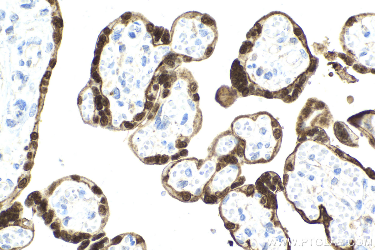 Immunohistochemical analysis of paraffin-embedded human placenta tissue slide using KHC2162 (TFAP2A IHC Kit).