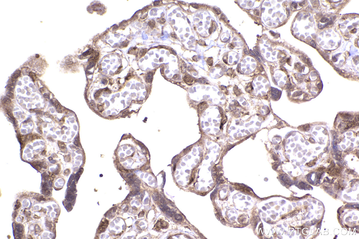 Immunohistochemical analysis of paraffin-embedded human placenta tissue slide using KHC2342 (TGFB2 IHC Kit).