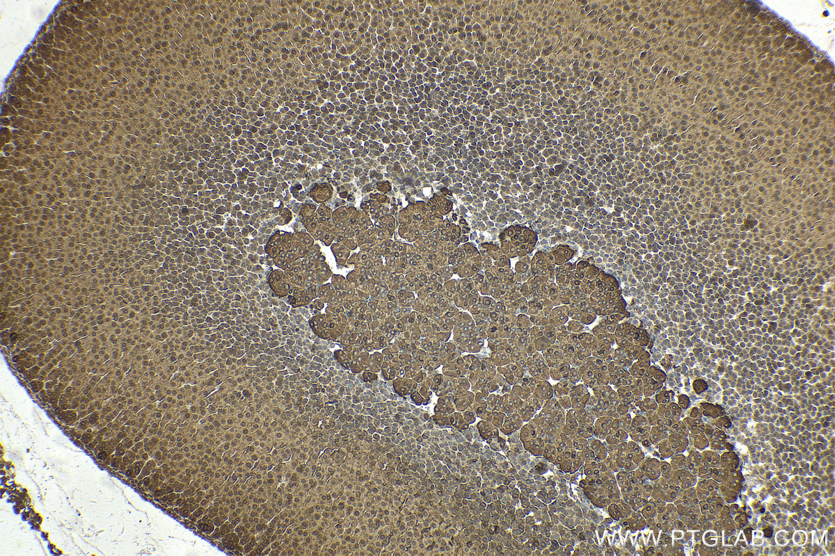 Immunohistochemical analysis of paraffin-embedded mouse adrenal gland tissue slide using KHC2188 (TH IHC Kit).