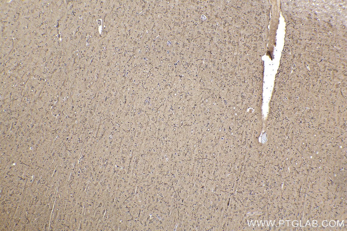 Immunohistochemical analysis of paraffin-embedded rat brain tissue slide using KHC2188 (TH IHC Kit).