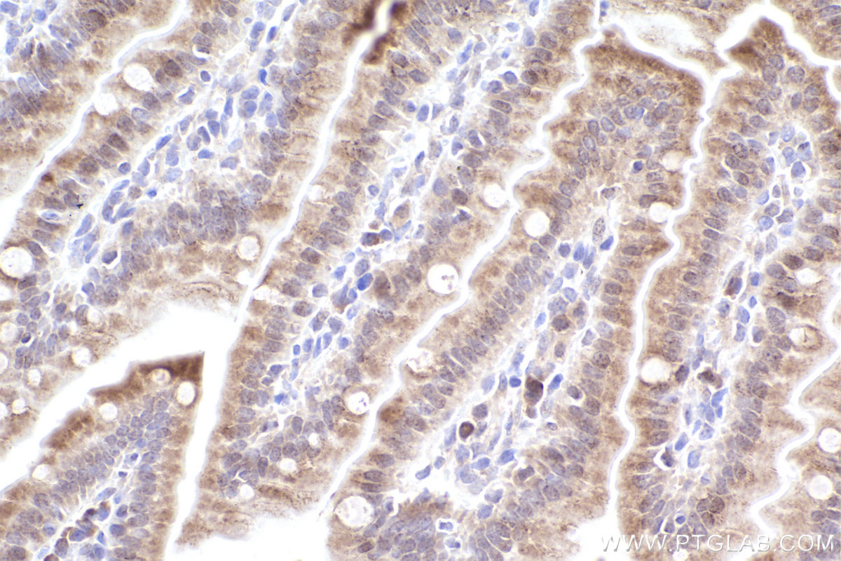 Immunohistochemical analysis of paraffin-embedded mouse small intestine tissue slide using KHC2541 (TMEM41B IHC Kit).