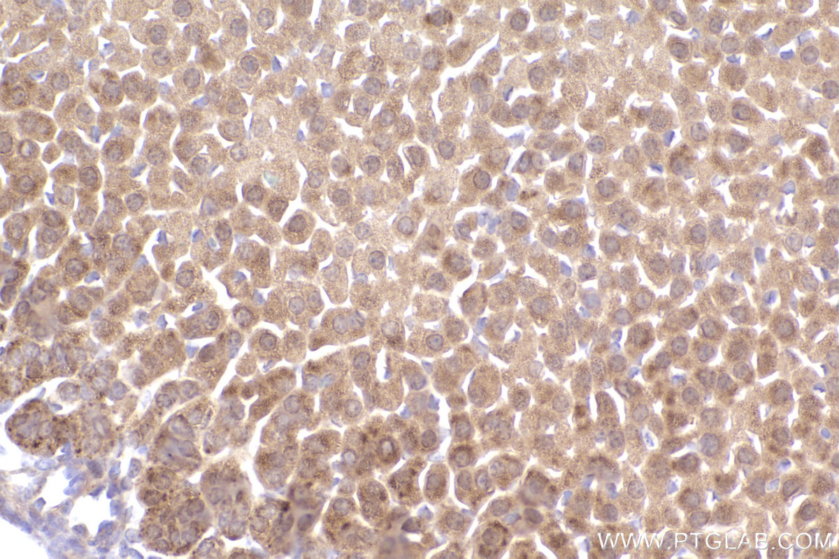 Immunohistochemical analysis of paraffin-embedded mouse adrenal gland tissue slide using KHC2541 (TMEM41B IHC Kit).