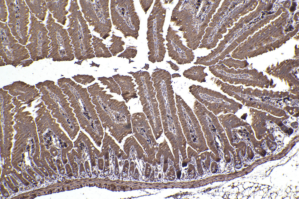 Immunohistochemical analysis of paraffin-embedded mouse small intestine tissue slide using KHC2443 (TNFAIP1 IHC Kit).