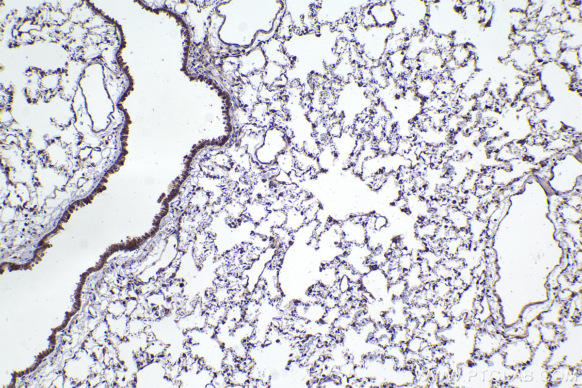 Immunohistochemical analysis of paraffin-embedded rat lung tissue slide using KHC2428 (TNK1 IHC Kit).