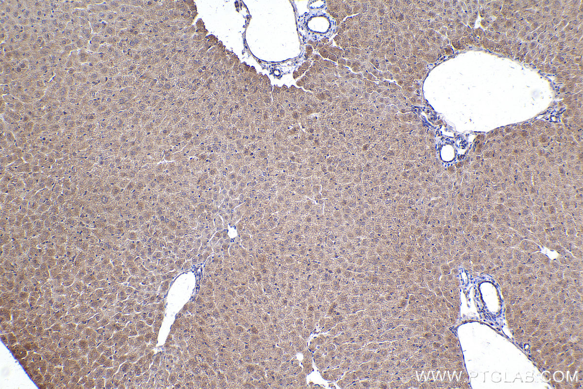 Immunohistochemical analysis of paraffin-embedded mouse liver tissue slide using KHC2428 (TNK1 IHC Kit).