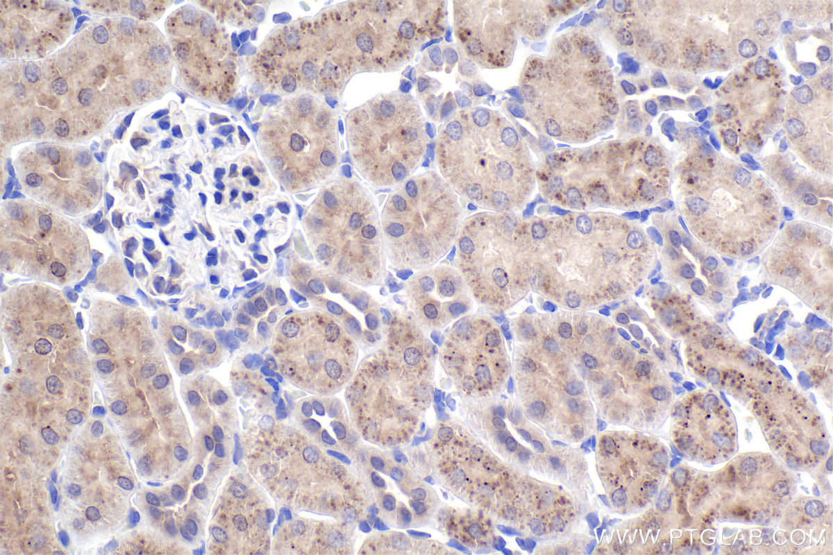 Immunohistochemical analysis of paraffin-embedded rat kidney tissue slide using KHC2401 (TNK2/ACK1 IHC Kit).