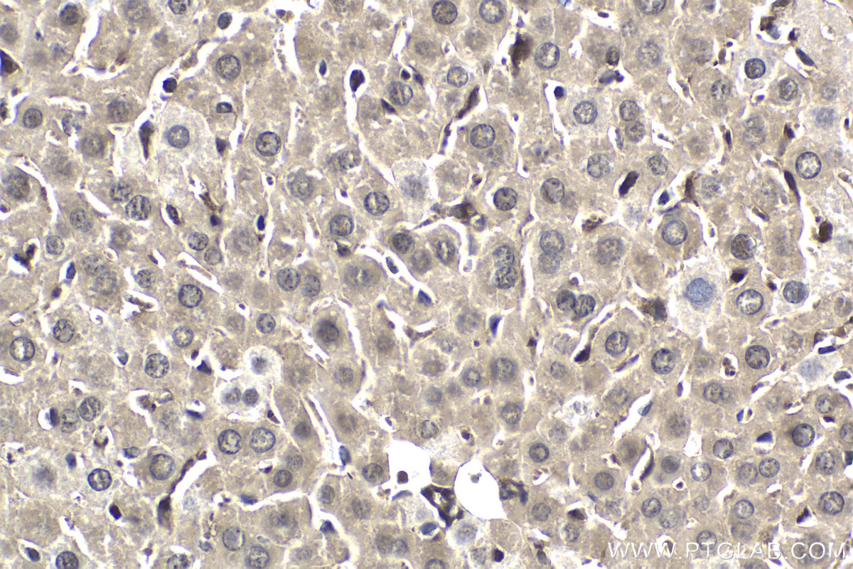 Immunohistochemical analysis of paraffin-embedded mouse liver tissue slide using KHC1928 (TNKS2 IHC Kit).