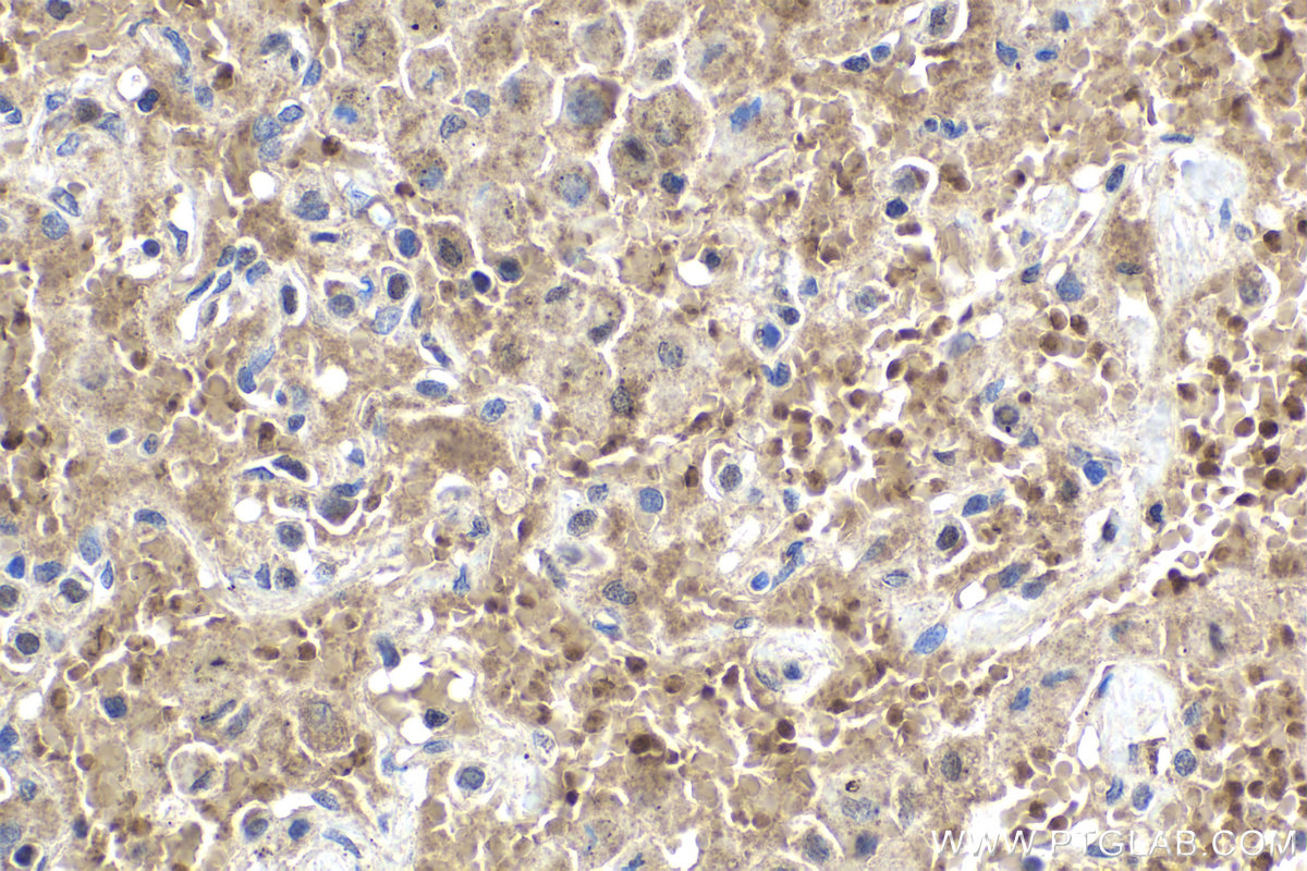 Immunohistochemical analysis of paraffin-embedded human lung tissue slide using KHC1928 (TNKS2 IHC Kit).