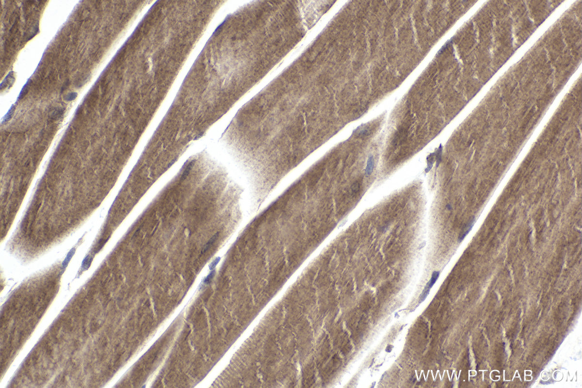 Immunohistochemical analysis of paraffin-embedded mouse skeletal muscle tissue slide using KHC1928 (TNKS2 IHC Kit).