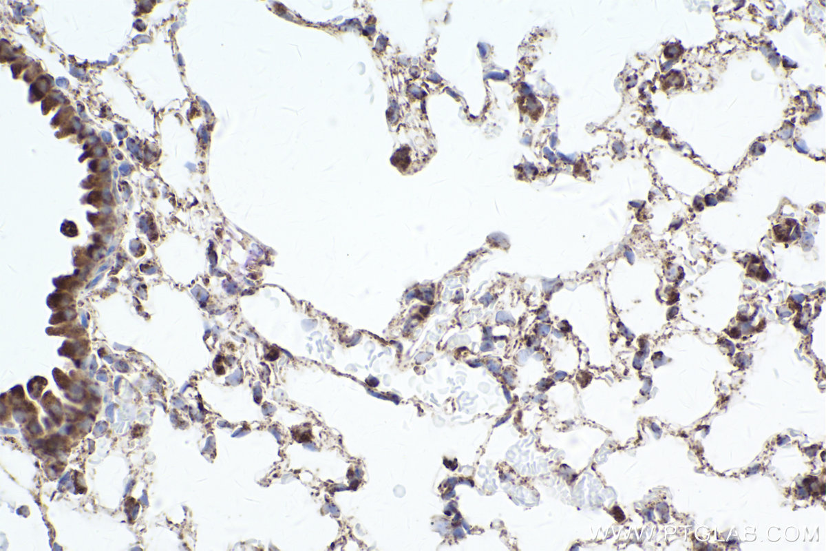 Immunohistochemical analysis of paraffin-embedded mouse lung tissue slide using KHC2487 (TOMM20 IHC Kit).