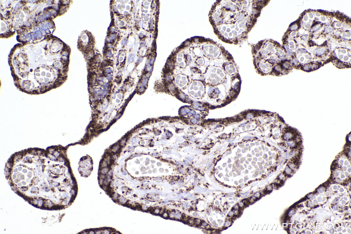 Immunohistochemical analysis of paraffin-embedded human placenta tissue slide using KHC2487 (TOMM20 IHC Kit).