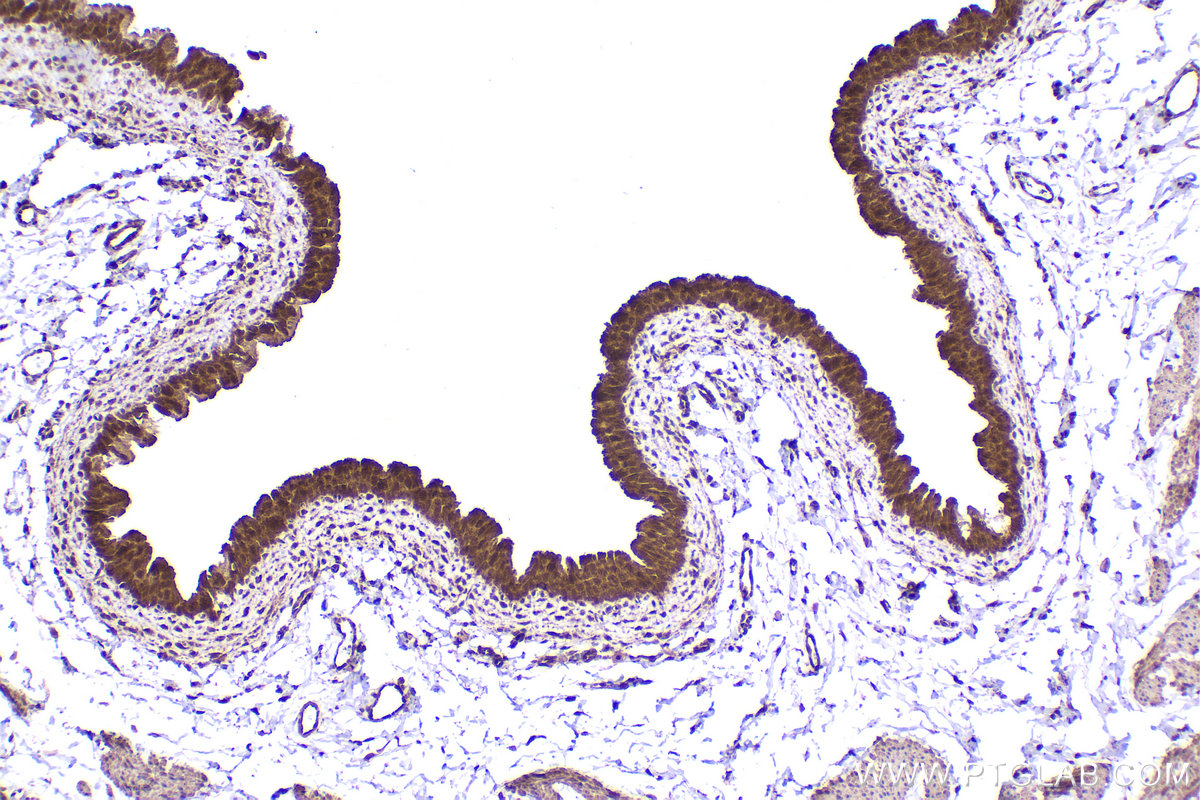 Immunohistochemical analysis of paraffin-embedded rat bladder tissue slide using KHC2439 (TP53BP2 IHC Kit).