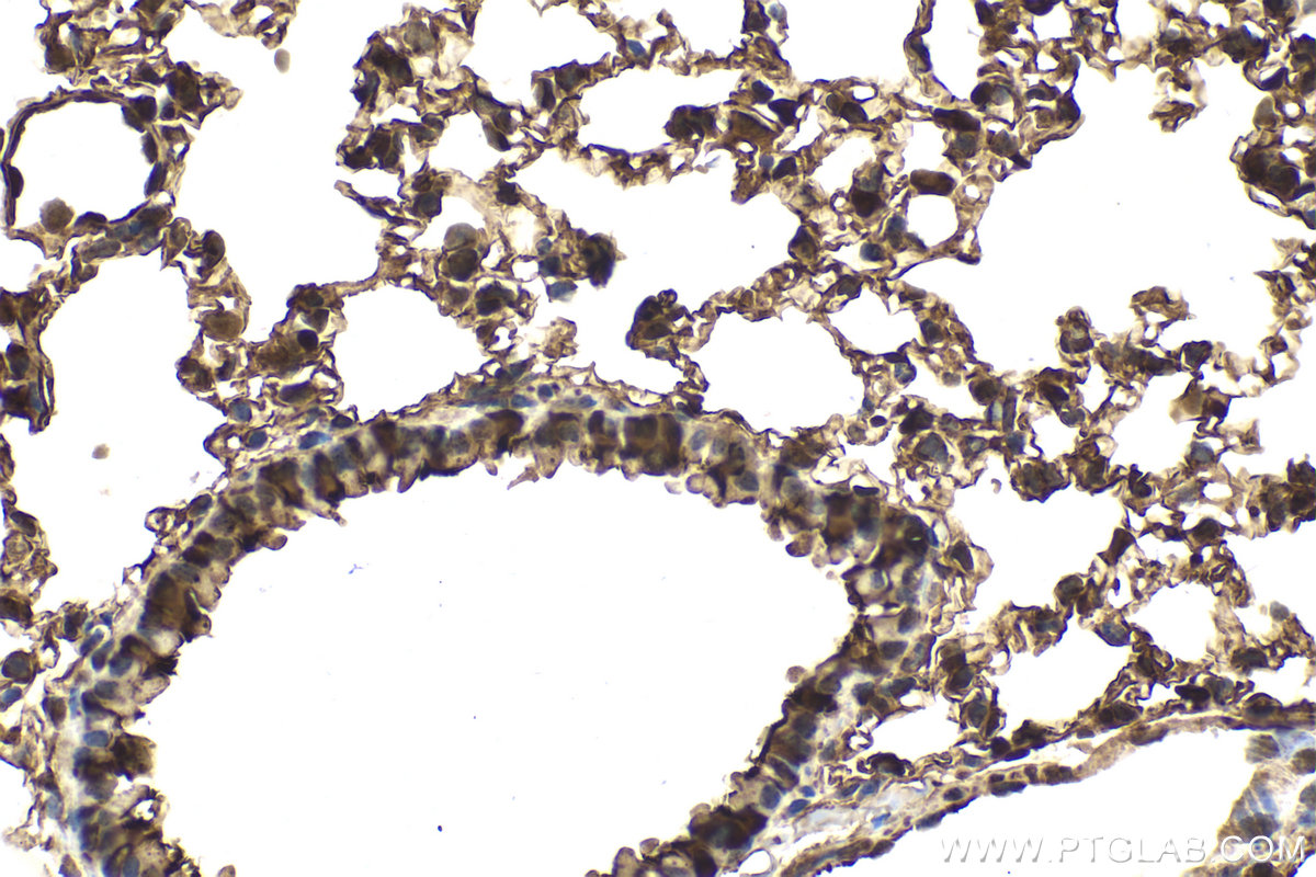 Immunohistochemical analysis of paraffin-embedded mouse lung tissue slide using KHC2129 (TPPP IHC Kit).
