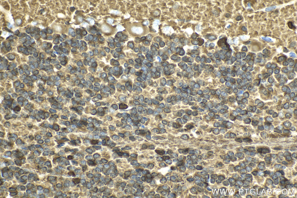 Immunohistochemical analysis of paraffin-embedded rat cerebellum tissue slide using KHC2129 (TPPP IHC Kit).