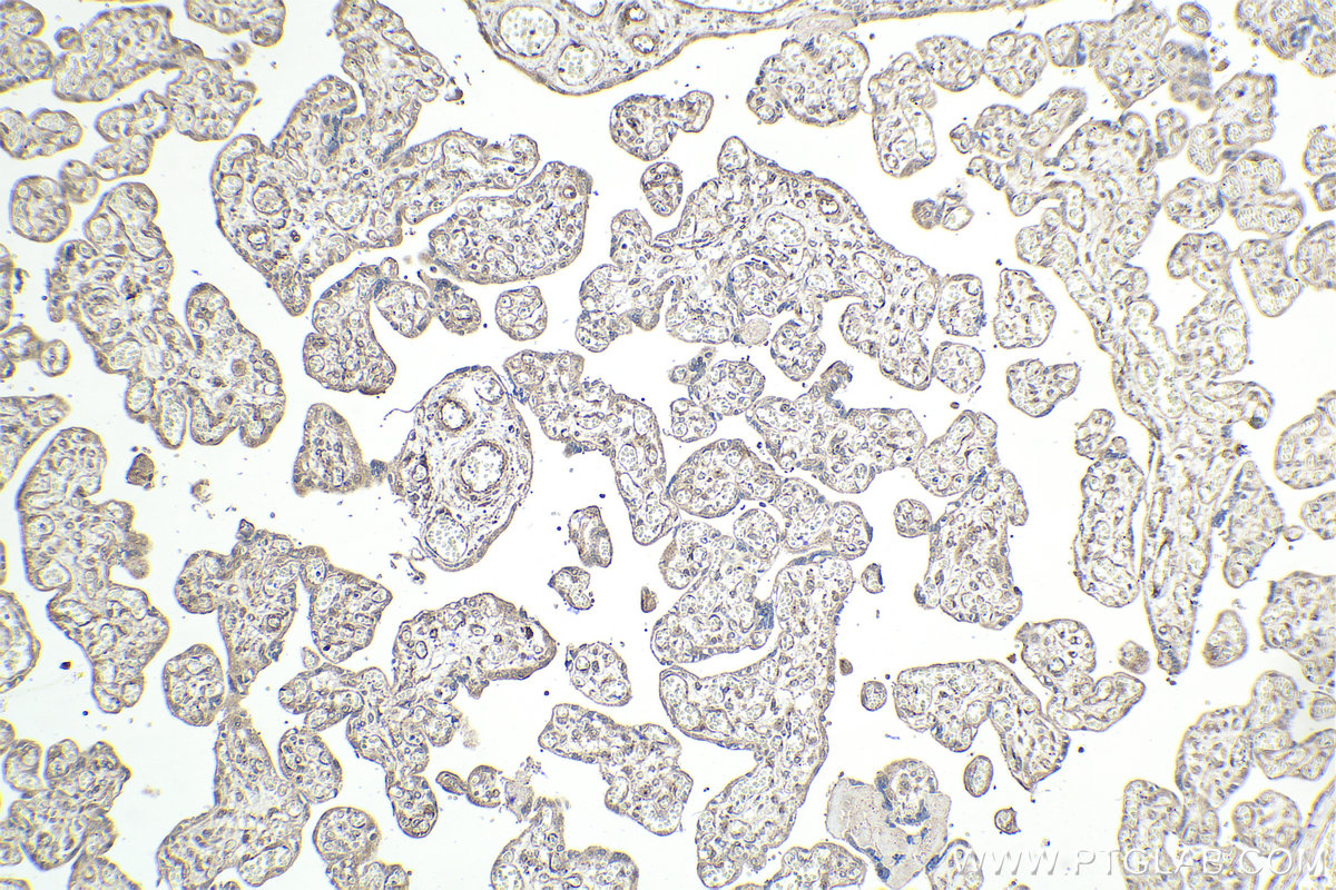 Immunohistochemical analysis of paraffin-embedded human placenta tissue slide using KHC2095 (TRAK2 IHC Kit).