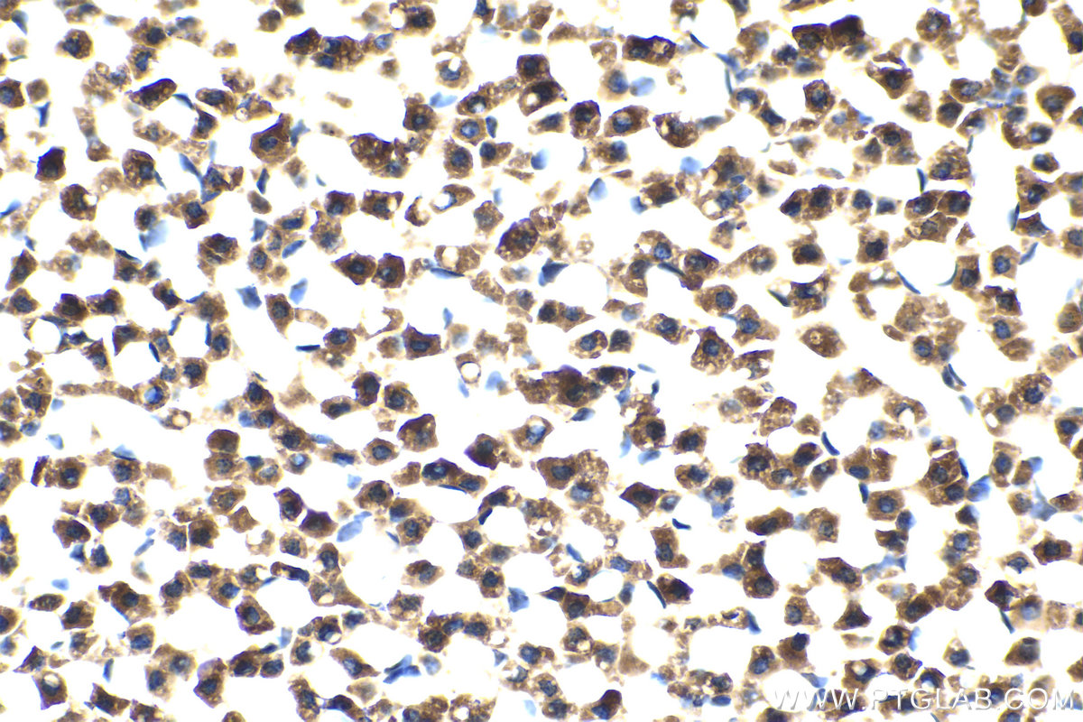 Immunohistochemical analysis of paraffin-embedded rat adrenal gland tissue slide using KHC2092 (TRIAP1 IHC Kit).