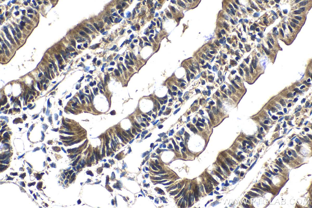Immunohistochemical analysis of paraffin-embedded rat small intestine tissue slide using KHC2092 (TRIAP1 IHC Kit).