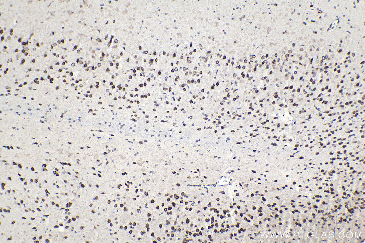 Immunohistochemical analysis of paraffin-embedded rat brain tissue slide using KHC2125 (TRIO IHC Kit).