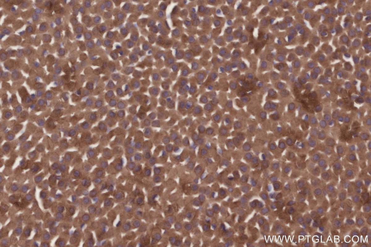 Immunohistochemical analysis of paraffin-embedded mouse adrenal gland tissue slide using KHC2723 (TRPC4AP IHC Kit).