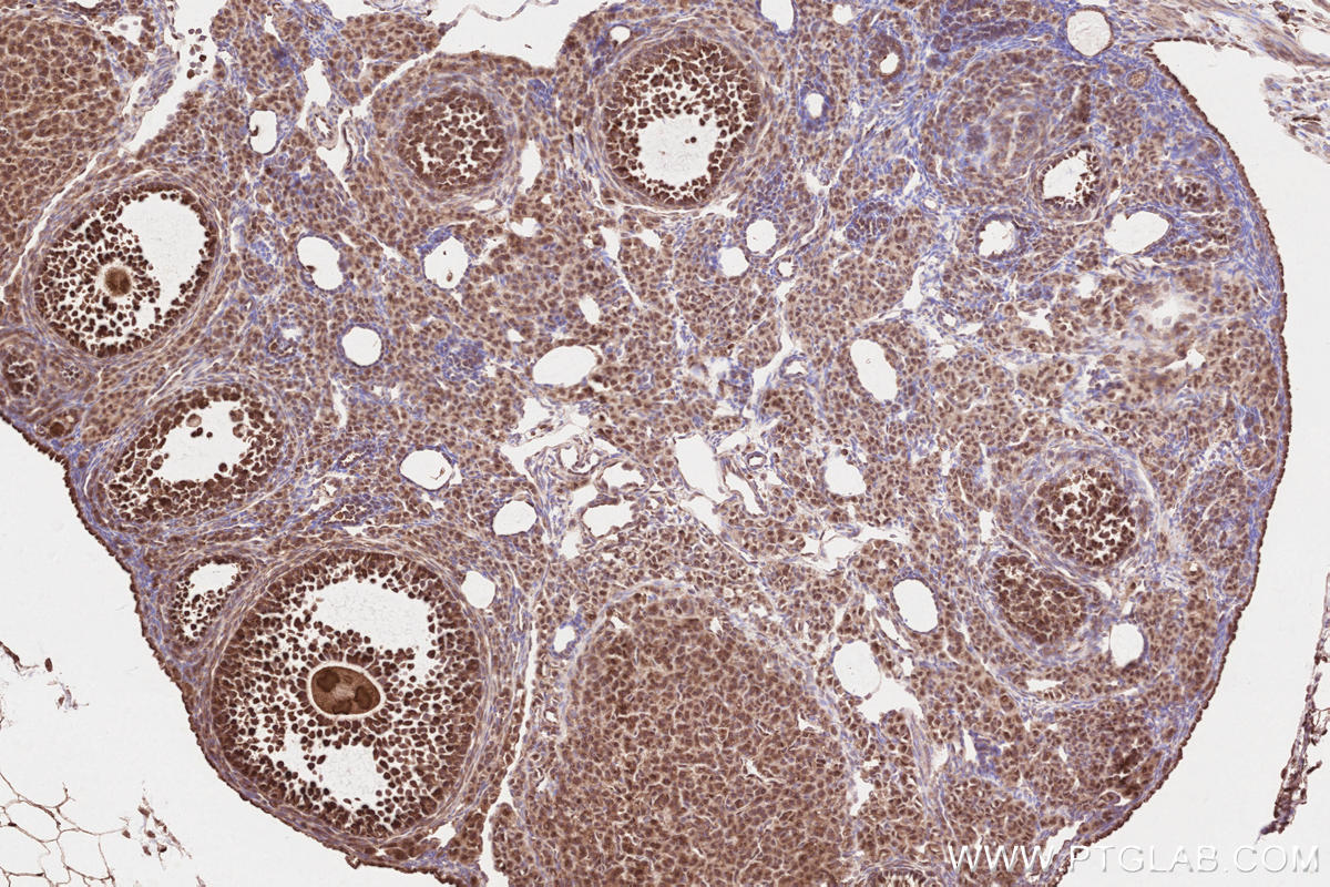 Immunohistochemical analysis of paraffin-embedded mouse ovary tissue slide using KHC2582 (TTBK2 IHC Kit).