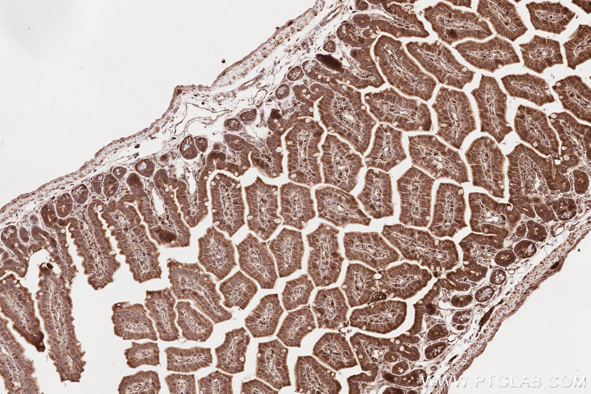 Immunohistochemical analysis of paraffin-embedded mouse small intestine tissue slide using KHC2582 (TTBK2 IHC Kit).