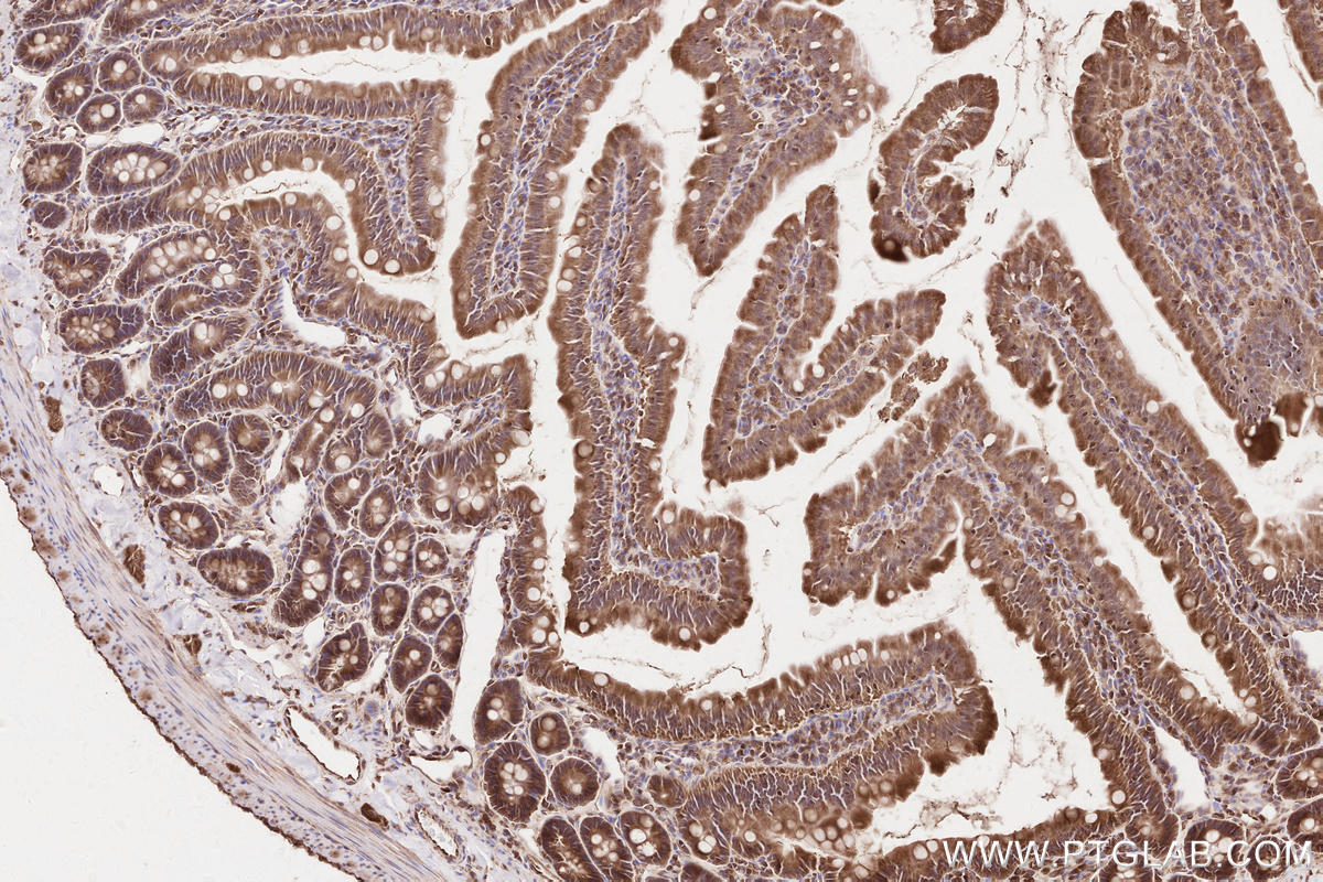 Immunohistochemical analysis of paraffin-embedded rat small intestine tissue slide using KHC2582 (TTBK2 IHC Kit).