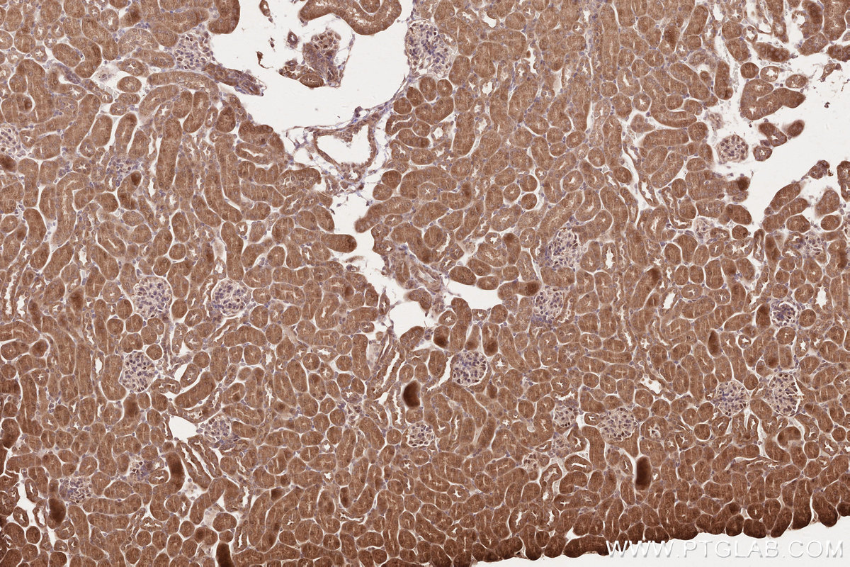 Immunohistochemical analysis of paraffin-embedded mouse kidney tissue slide using KHC2575 (TTC19 IHC Kit).