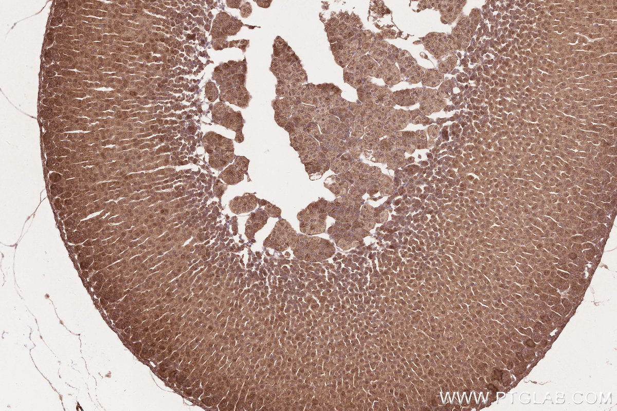 Immunohistochemical analysis of paraffin-embedded mouse adrenal gland tissue slide using KHC2575 (TTC19 IHC Kit).