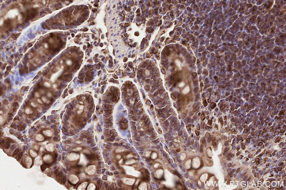 Immunohistochemical analysis of paraffin-embedded mouse colon tissue slide using KHC2610 (TUBA1A  IHC Kit).