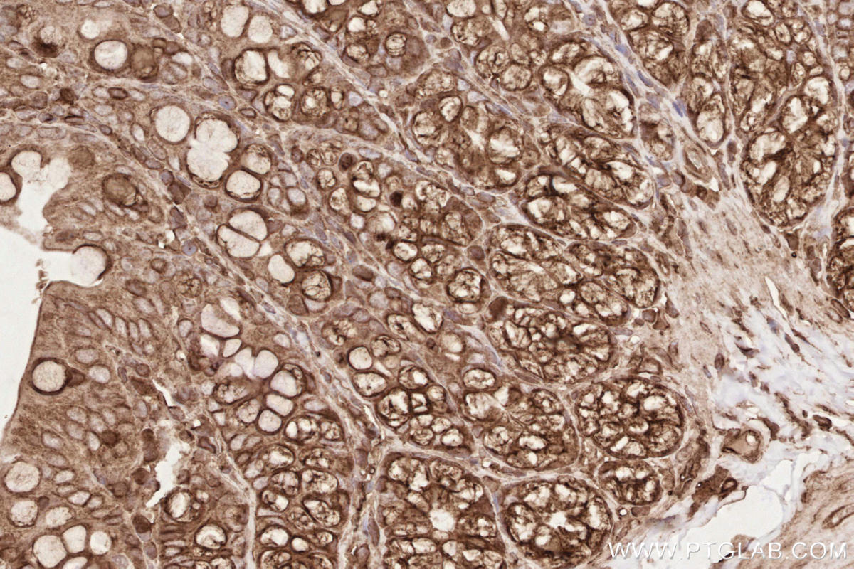 Immunohistochemical analysis of paraffin-embedded rat colon tissue slide using KHC2610 (TUBA1A  IHC Kit).