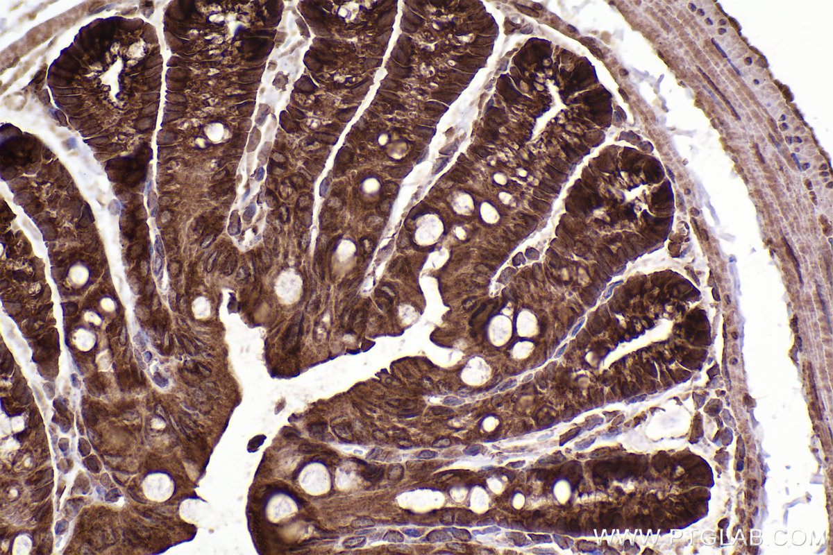 Immunohistochemical analysis of paraffin-embedded mouse colon tissue slide using KHC2407 (TWF1 IHC Kit).