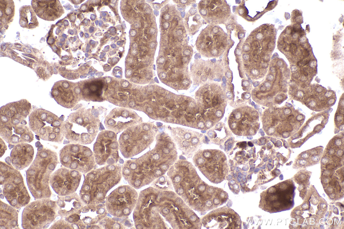 Immunohistochemical analysis of paraffin-embedded mouse kidney tissue slide using KHC2407 (TWF1 IHC Kit).