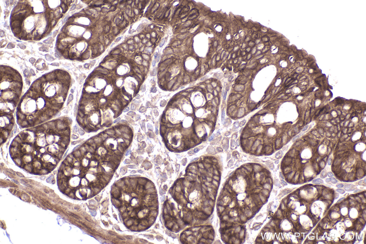 Immunohistochemical analysis of paraffin-embedded rat colon tissue slide using KHC2407 (TWF1 IHC Kit).