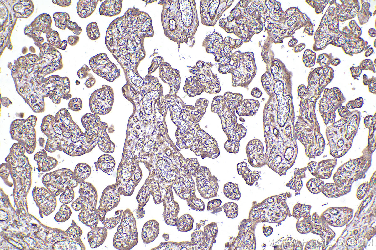 Immunohistochemical analysis of paraffin-embedded human placenta tissue slide using KHC2395 (TYRO3 IHC Kit).