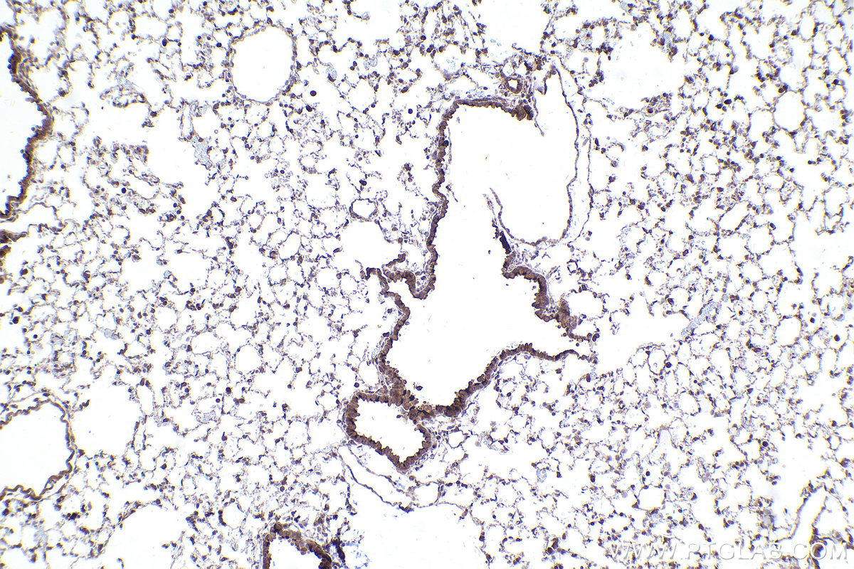 Immunohistochemical analysis of paraffin-embedded mouse lung tissue slide using KHC2395 (TYRO3 IHC Kit).