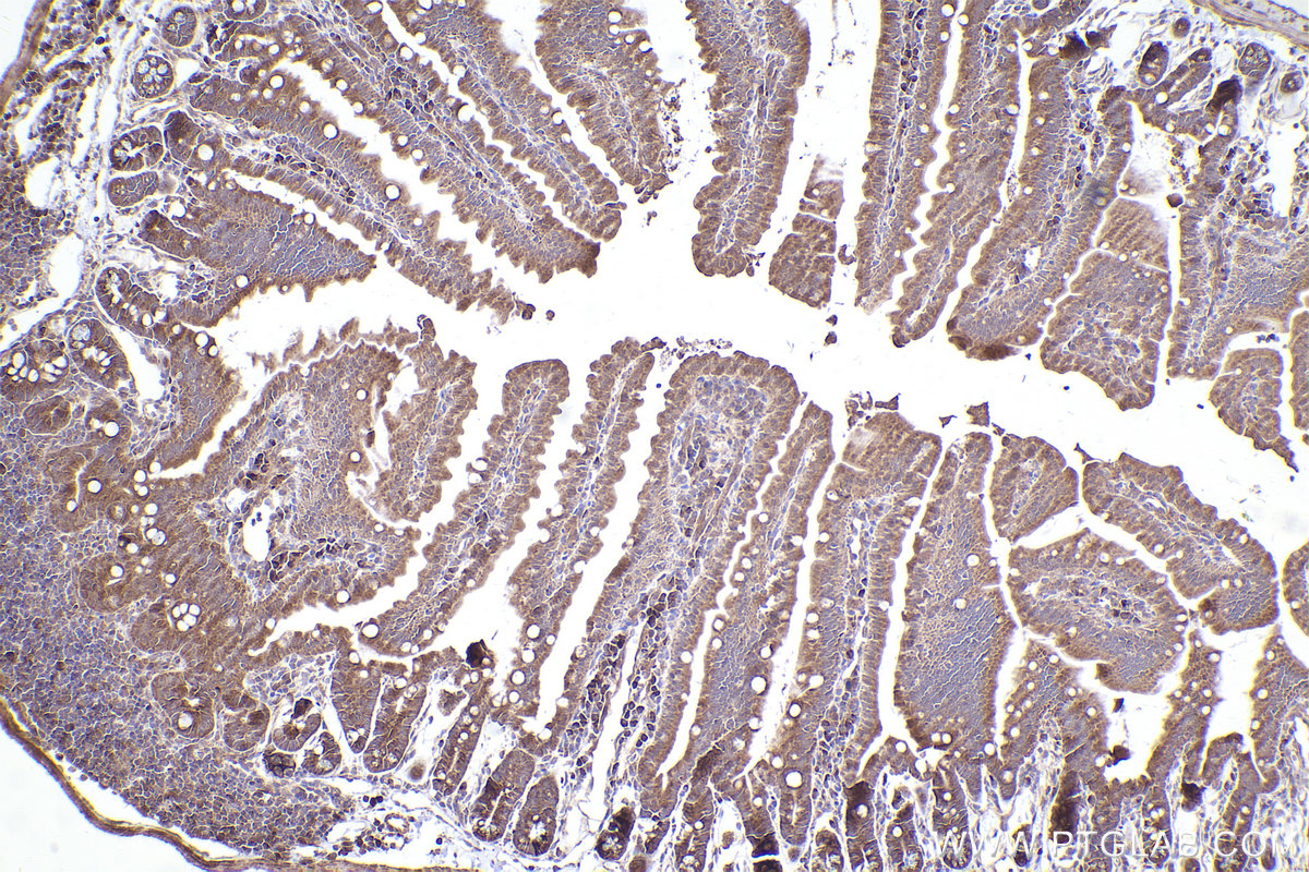 Immunohistochemical analysis of paraffin-embedded mouse small intestine tissue slide using KHC2395 (TYRO3 IHC Kit).