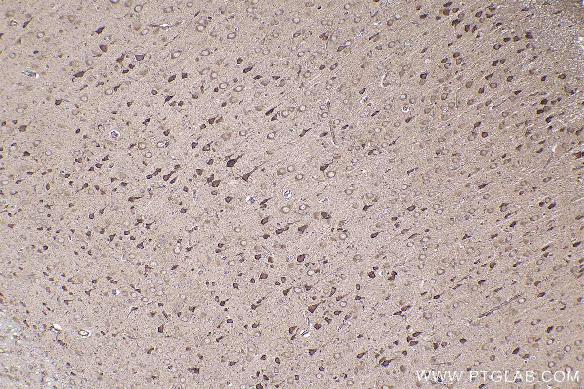 Immunohistochemical analysis of paraffin-embedded rat brain tissue slide using KHC2395 (TYRO3 IHC Kit).