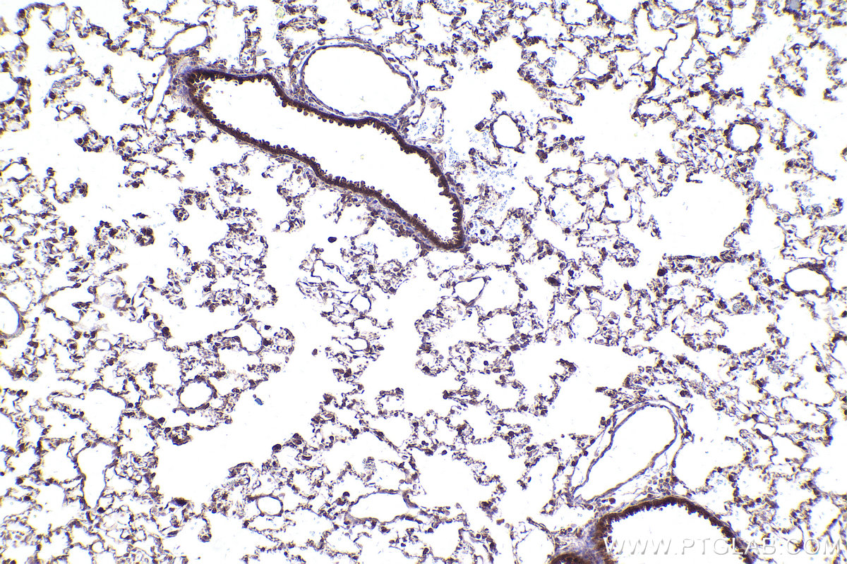 Immunohistochemical analysis of paraffin-embedded rat lung tissue slide using KHC2395 (TYRO3 IHC Kit).