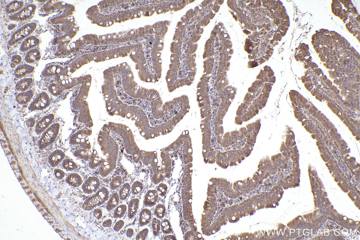 Immunohistochemical analysis of paraffin-embedded rat small intestine tissue slide using KHC2395 (TYRO3 IHC Kit).