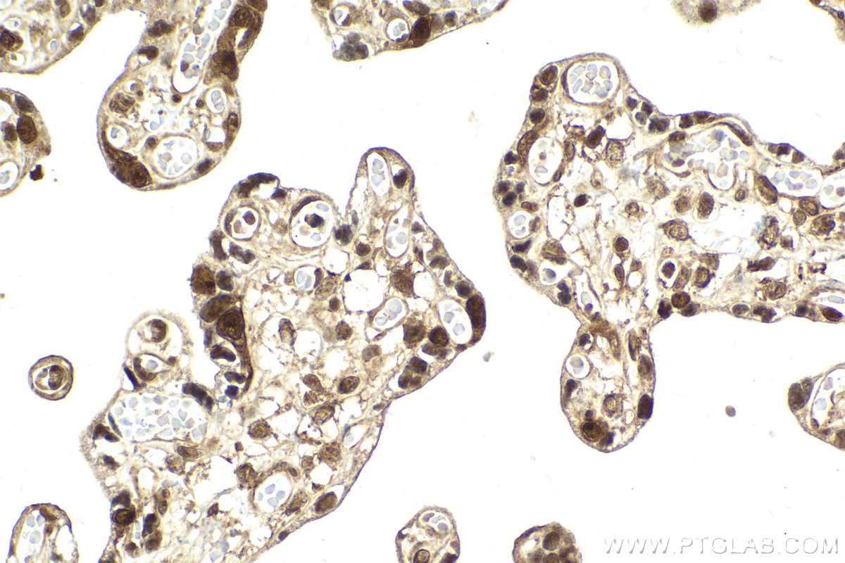 Immunohistochemical analysis of paraffin-embedded human placenta tissue slide using KHC2134 (UBE4B IHC Kit).