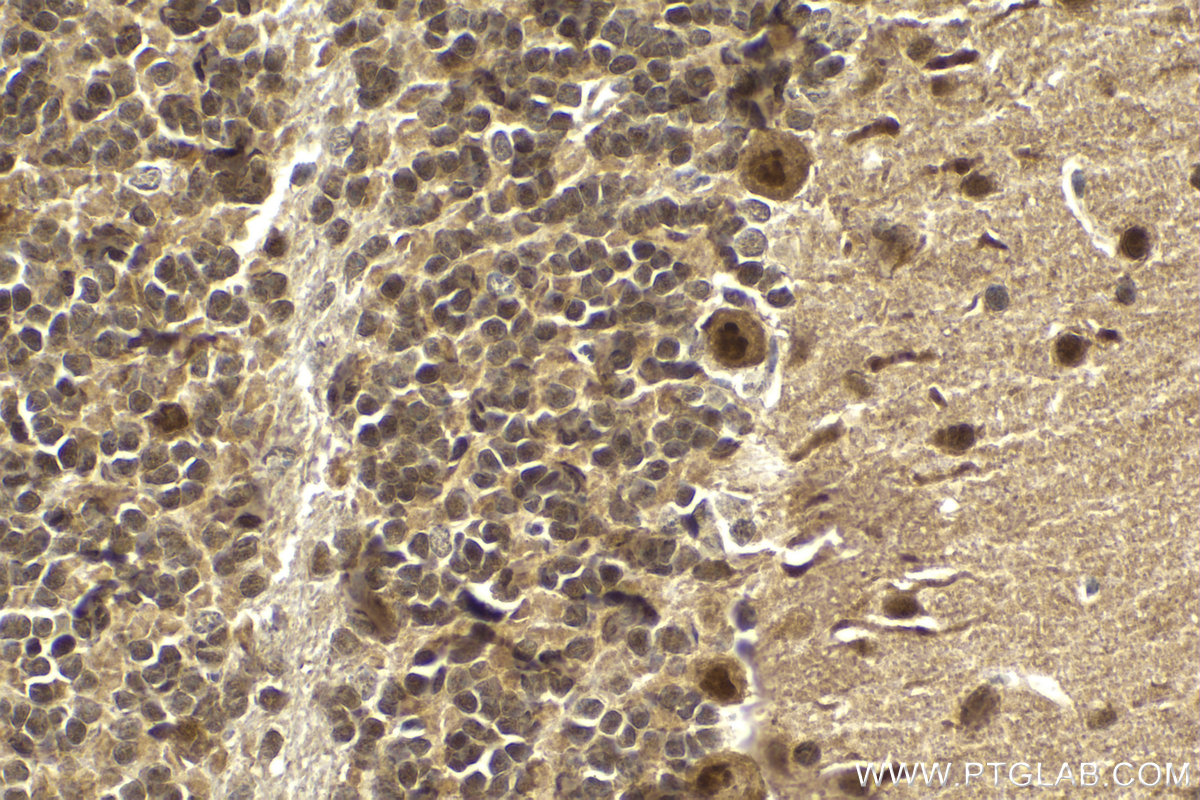 Immunohistochemical analysis of paraffin-embedded mouse cerebellum tissue slide using KHC2134 (UBE4B IHC Kit).