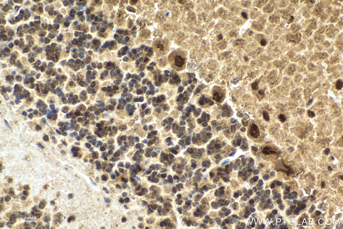 Immunohistochemical analysis of paraffin-embedded rat cerebellum tissue slide using KHC2134 (UBE4B IHC Kit).