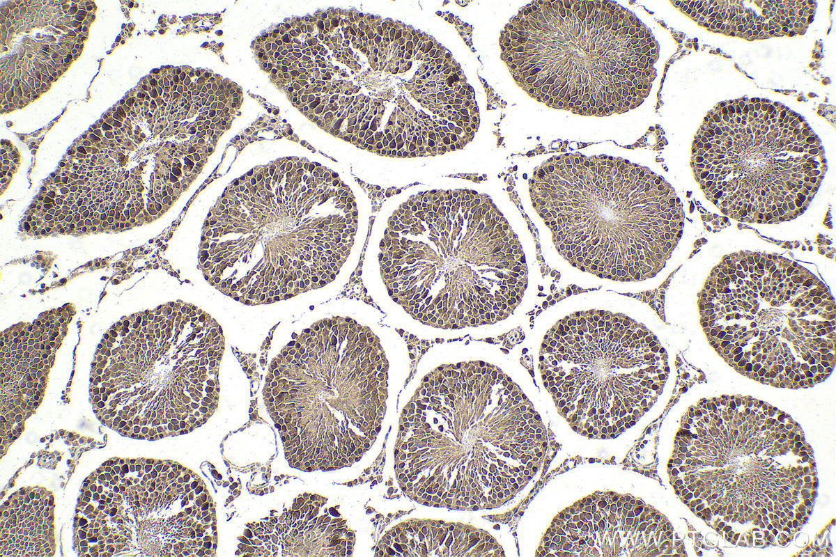 Immunohistochemical analysis of paraffin-embedded rat testis tissue slide using KHC2134 (UBE4B IHC Kit).